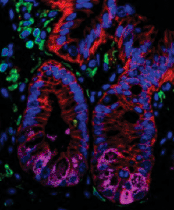 Image: A histologic section of intestinal tissue isolated from healthy mice stained to visualize intestinal epithelial cells (EpCAM, red), including Paneth cells (lysozyme, magenta), as well as immune cells (CD45, green) Nuclei are stained with DAPI (blue) (Photo courtesy of the University of Pennsylvania).